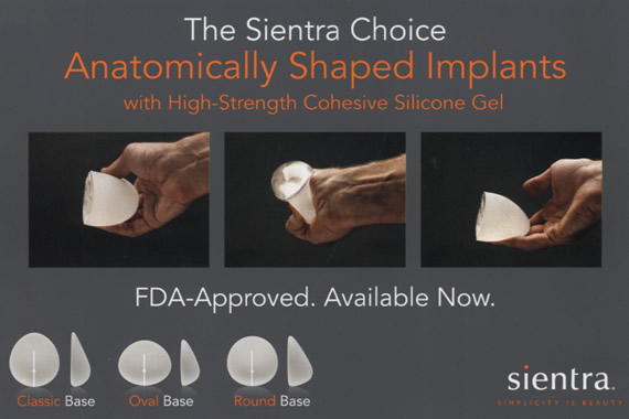 Sientra Implant Size Chart